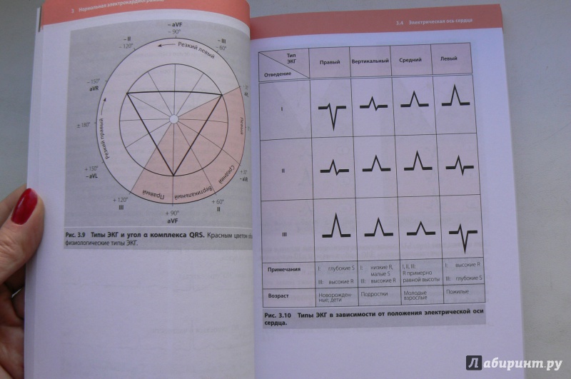 Иллюстрация 20 из 31 для Клиническая интерпретация ЭКГ. Введение в электрокардиографию - Кук-Суп Со | Лабиринт - книги. Источник: Марина