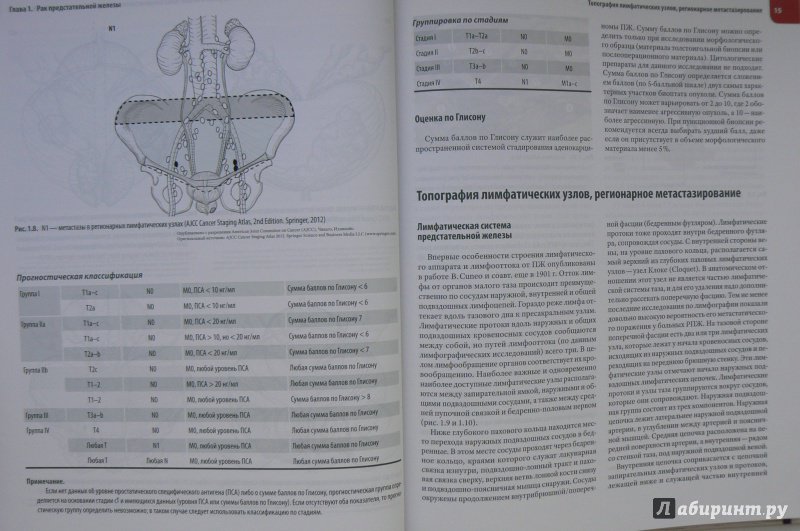 Иллюстрация 3 из 6 для Атлас операций при злокачественных опухолях органов мочеполовой системы - Каприн, Русаков, Алексеев | Лабиринт - книги. Источник: Марина