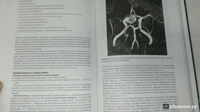 Иллюстрация 8 из 12 для Частная неврология - Суслина, Максимова | Лабиринт - книги. Источник: Савчук Ирина