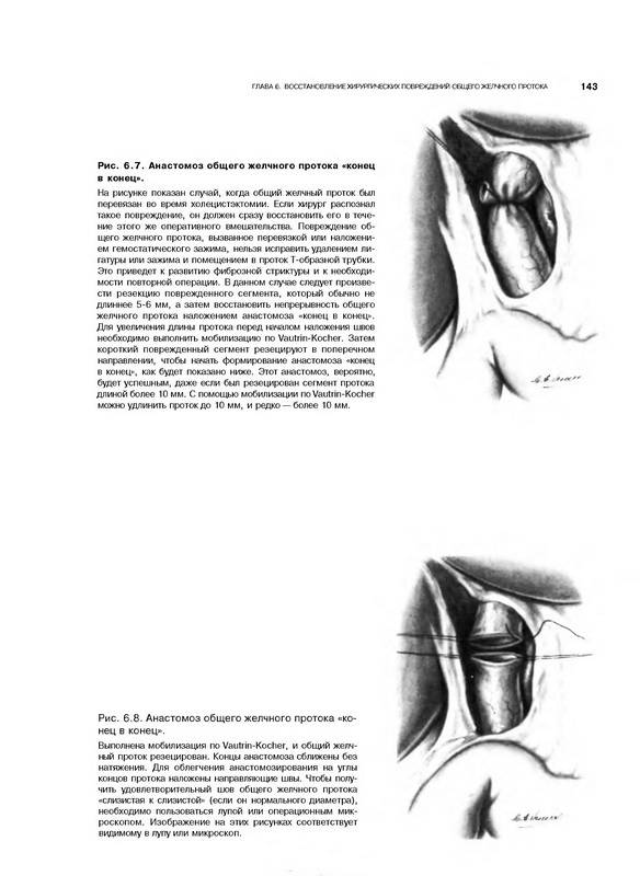 Иллюстрация 24 из 44 для Атлас абдоминальной хирургии. Том 1. Хирургия печени, желчных путей, поджелудочной железы - Эмилио Итала | Лабиринт - книги. Источник: Риззи
