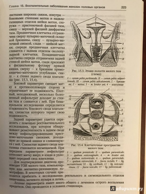 Иллюстрация 17 из 26 для Гинекология - Айламазян, Яковлев, Рябцева | Лабиринт - книги. Источник: Ромыдтчъ