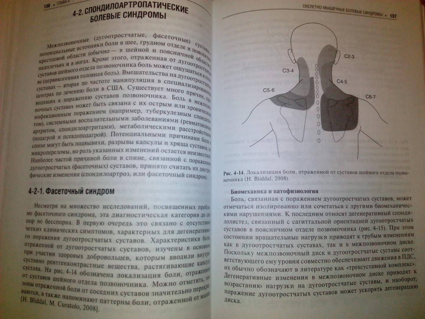 Иллюстрация 10 из 15 для Боль в спине - Подчуфарова, Яхно | Лабиринт - книги. Источник: Eugeni