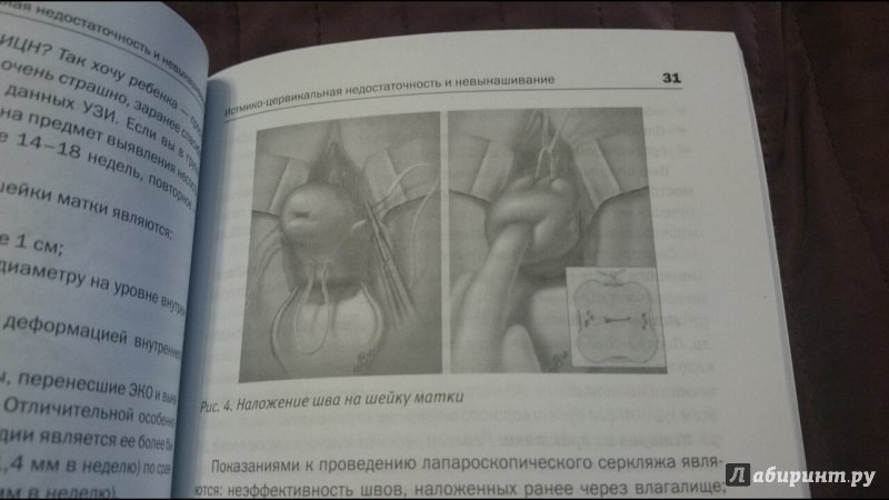 Иллюстрация 15 из 17 для Невынашивание беременности - Ольга Панкова | Лабиринт - книги. Источник: anka46