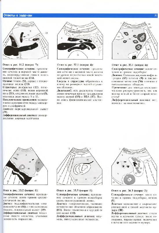 Иллюстрация 12 из 14 для Ультразвуковая диагностика. Базовый курс - Хофер, Райхс | Лабиринт - книги. Источник: Юта