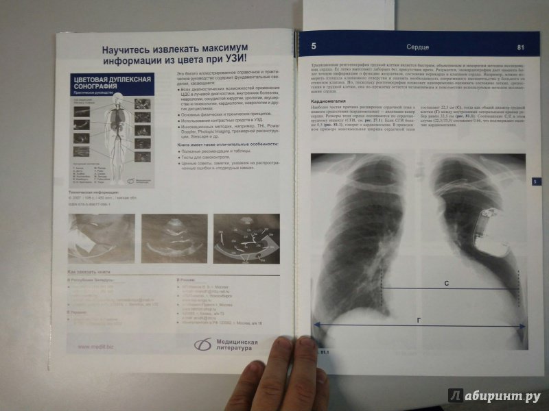 Иллюстрация 4 из 32 для Рентгенологическое исследование грудной клетки. Практическое руководство - Матиас Хофер | Лабиринт - книги. Источник: Лабиринт