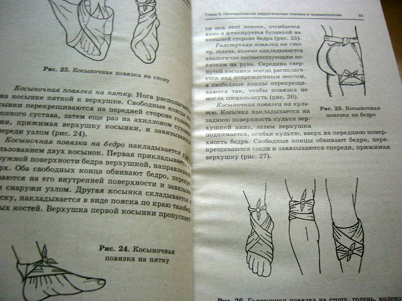 Иллюстрация 4 из 19 для Практическое руководство по травматологии для фельдшеров - Барыкина, Кабарухин | Лабиринт - книги. Источник: Nika