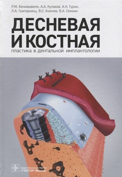 Иллюстрация 2 из 4 для Десневая и костная пластика в дентальной имплантологии - Бениашвили, Кулаков, Гурин | Лабиринт - книги. Источник: книпкноп