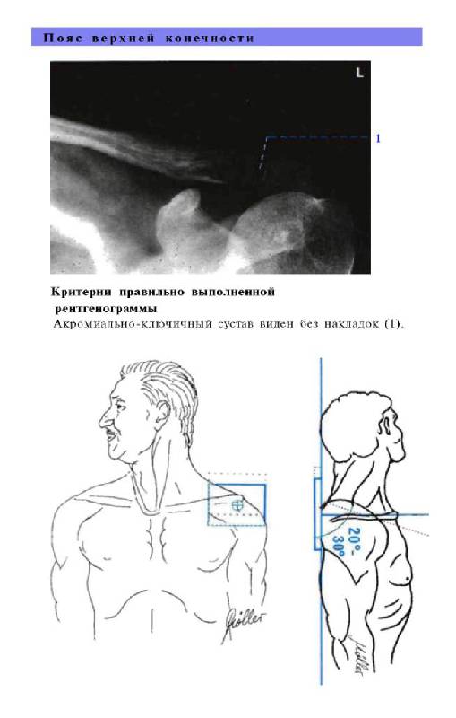 Иллюстрация 17 из 29 для Атлас рентгенологических укладок - Меллер, Райф | Лабиринт - книги. Источник: Юта
