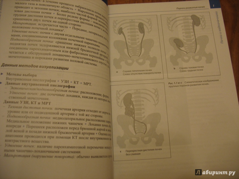 Иллюстрация 22 из 23 для Лучевая диагностика. Болезни мочеполовой системы - Хамм, Асбах, Бейерсдорф, Хайн, Лемке | Лабиринт - книги. Источник: Крелена