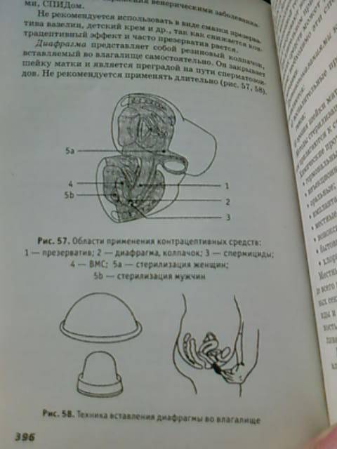 Иллюстрация 6 из 6 для Акушерство и гинекология. Практикум - Изабелла Славянова | Лабиринт - книги. Источник: lettrice