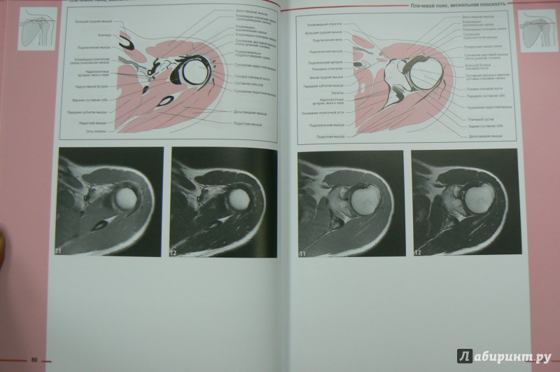Иллюстрация 5 из 15 для МРТ костно-мышечной системы. Атлас - Роен, Лютьен-Дреколл, Хойк, Стайнборн | Лабиринт - книги. Источник: Марина