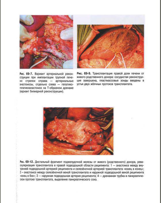 Иллюстрация 48 из 59 для Клиническая хирургия. Национальное руководство. В 3-х томах. Том 2 (+CD) | Лабиринт - книги. Источник: Федосов  Прохор Сергеевич