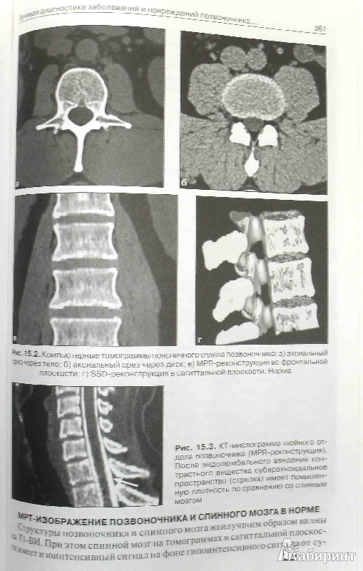 Иллюстрация 13 из 14 для Лучевая диагностика. Учебник. Том 1 - Труфанов, Багненко, Акиев, Атаев | Лабиринт - книги. Источник: ВраЧиталла
