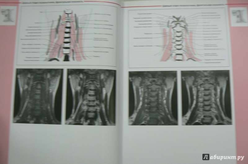 Иллюстрация 2 из 15 для МРТ костно-мышечной системы. Атлас - Роен, Лютьен-Дреколл, Хойк, Стайнборн | Лабиринт - книги. Источник: Марина