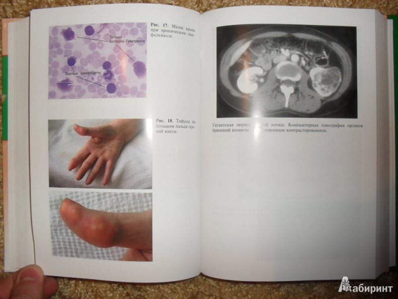 Иллюстрация 5 из 27 для Пропедевтика внутренних болезней. Учебник (+ CD) - Мухин, Моисеев | Лабиринт - книги. Источник: ВраЧиталла