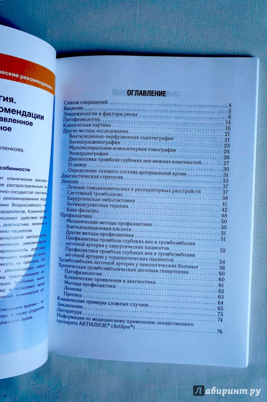Иллюстрация 3 из 7 для Тромбоэмболия легочной артерии: диагностика, лечение и профилактика - Гиляров, Андреев | Лабиринт - книги. Источник: sakedas