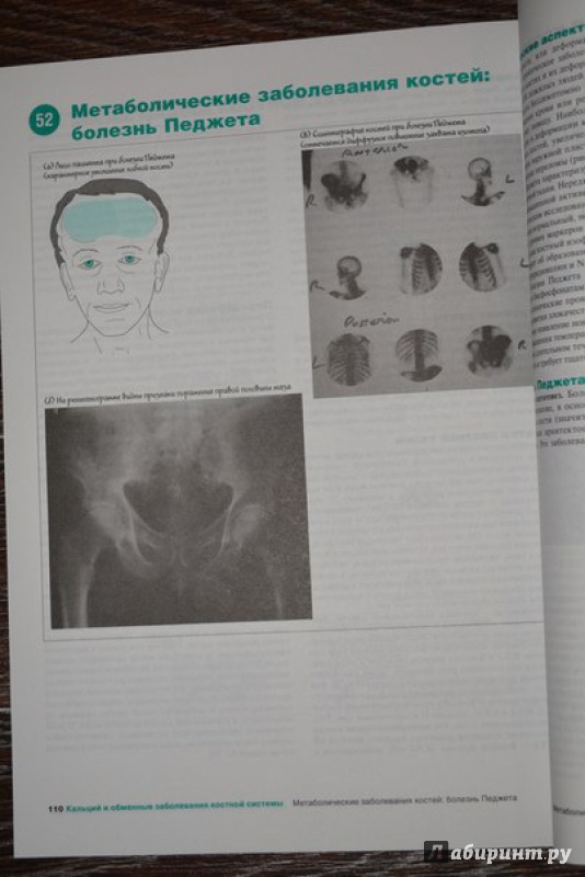 Иллюстрация 8 из 9 для Наглядная эндокринология - Гринстейн, Вуд | Лабиринт - книги. Источник: ВраЧиталла