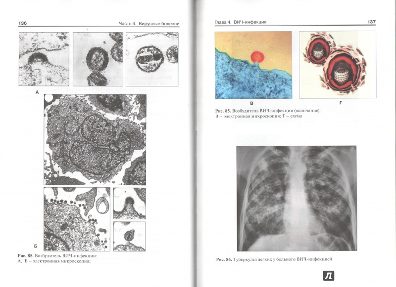 Иллюстрация 8 из 9 для Атлас инфекционных болезней - Лучшев, Жаров, Никифоров | Лабиринт - книги. Источник: ВраЧиталла