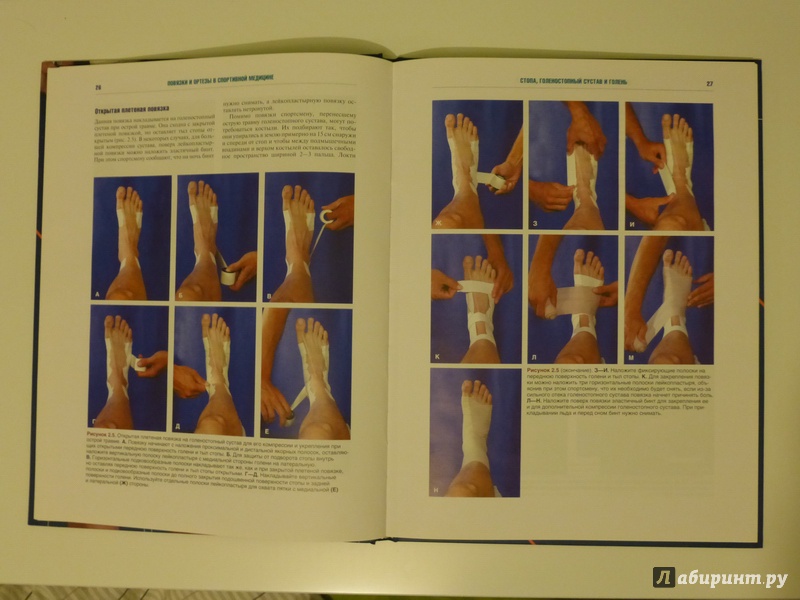 Иллюстрация 2 из 7 для Повязки и ортезы в спортивной медицине (+DVD) - Дэвид Перрин | Лабиринт - книги. Источник: wildwings