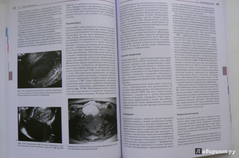 Иллюстрация 4 из 5 для Ультразвуковая диагностика. Практическое решение клинических проблем. Том 2 - Блют, Бенсон, Раллс | Лабиринт - книги. Источник: Марина