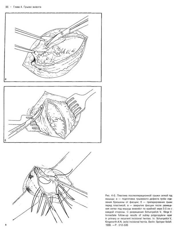 Иллюстрация 8 из 10 для Общая и неотложная хирургия | Лабиринт - книги. Источник: Ялина