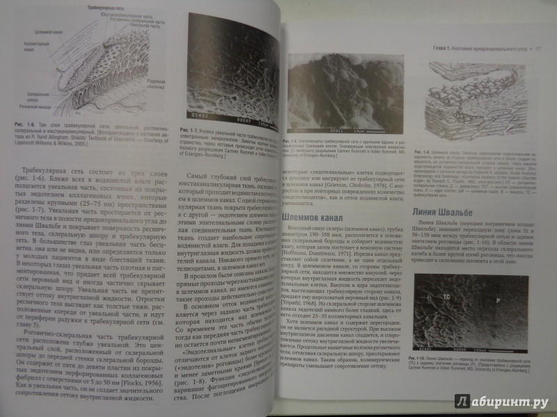 Иллюстрация 10 из 13 для Атлас по гониоскопии (+CD) - Олвэрд, Лонгмуа | Лабиринт - книги. Источник: Сокол-Ан
