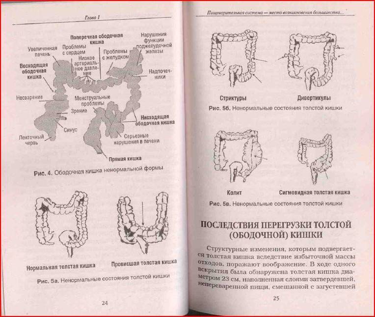 Иллюстрация 6 из 8 для Очистите свой организм от болезней - Андреас Мориц | Лабиринт - книги. Источник: aserebrov