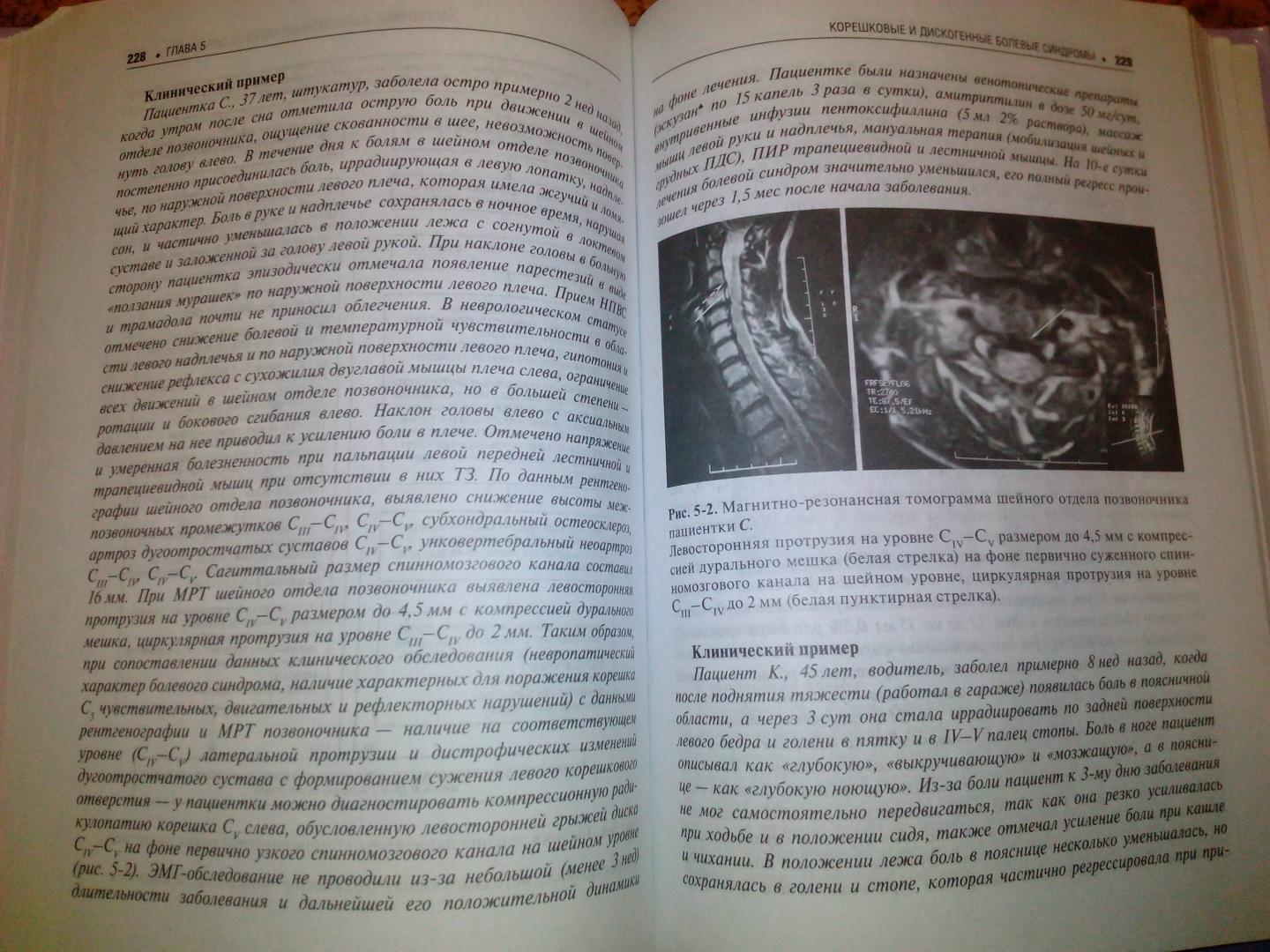 Иллюстрация 14 из 15 для Боль в спине - Подчуфарова, Яхно | Лабиринт - книги. Источник: Eugeni