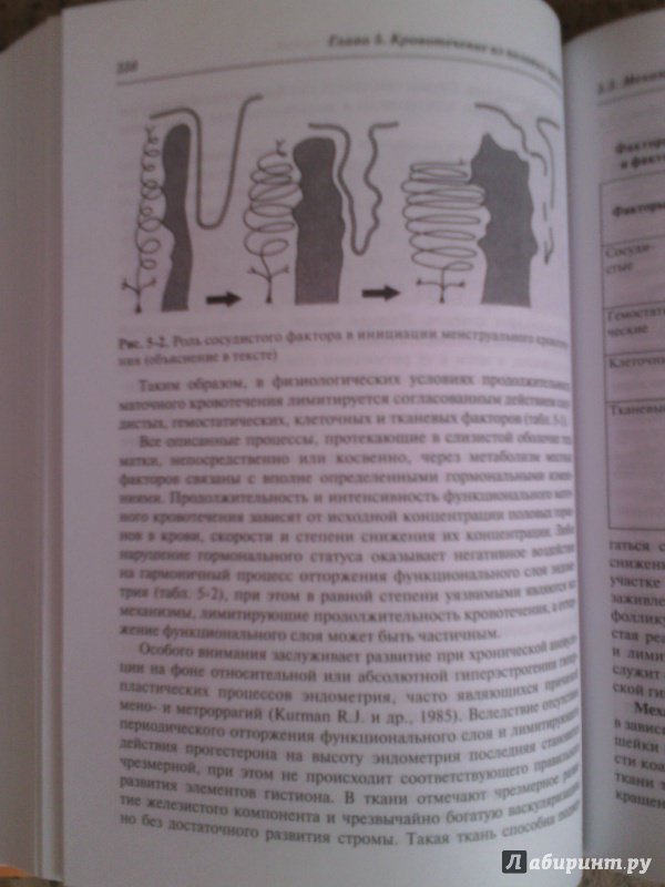 Иллюстрация 7 из 15 для Симптом, синдром, диагноз. Дифференциальная диагностика в гинекологии - Подзолкова, Глазкова | Лабиринт - книги. Источник: Лабиринт