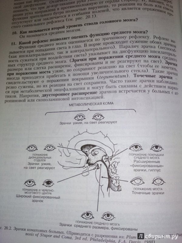 Иллюстрация 30 из 34 для Секреты клинической диагностики - Сальваторе Манджони | Лабиринт - книги. Источник: Лабиринт