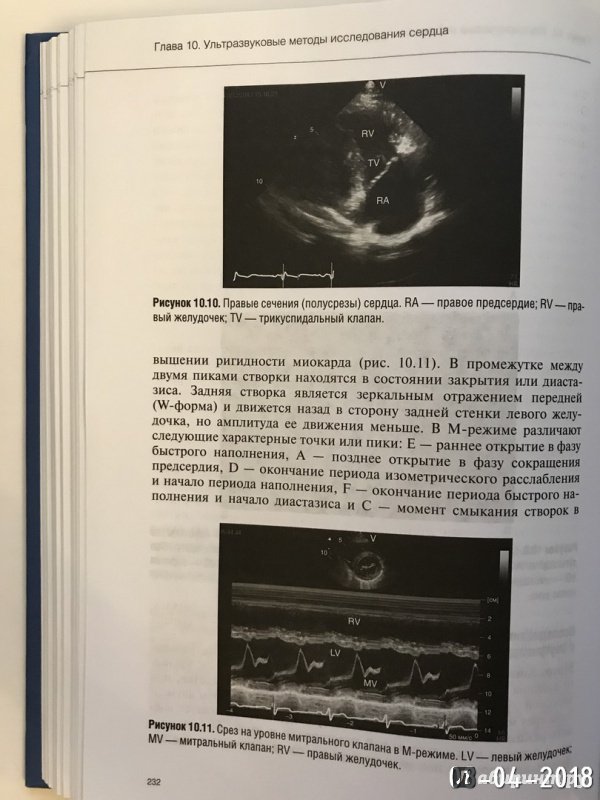 Иллюстрация 20 из 29 для Руководство по кардиологии. Том 2. Методы диагностики сердечно-сосудистых заболеваний | Лабиринт - книги. Источник: Ромыдтчъ