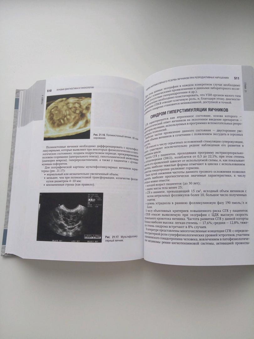 Иллюстрация 27 из 29 для Лучевая диагностика и терапия в акушерстве и гинекологии - Адамян, Гус, Демидов, Обельчак | Лабиринт - книги. Источник: Лабиринт