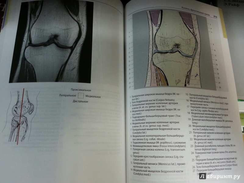 Иллюстрация 12 из 12 для Атлас секционной анатомии человека на примере КТ- и МРТ-срезов. Том 3. Позвоночник, конечности - Меллер, Райф | Лабиринт - книги. Источник: Den