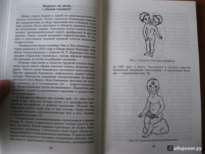 Иллюстрация 8 из 19 для Увлекательная анатомия. Чудеса и странности нашего тела - Вера Надеждина | Лабиринт - книги. Источник: Алечка1985
