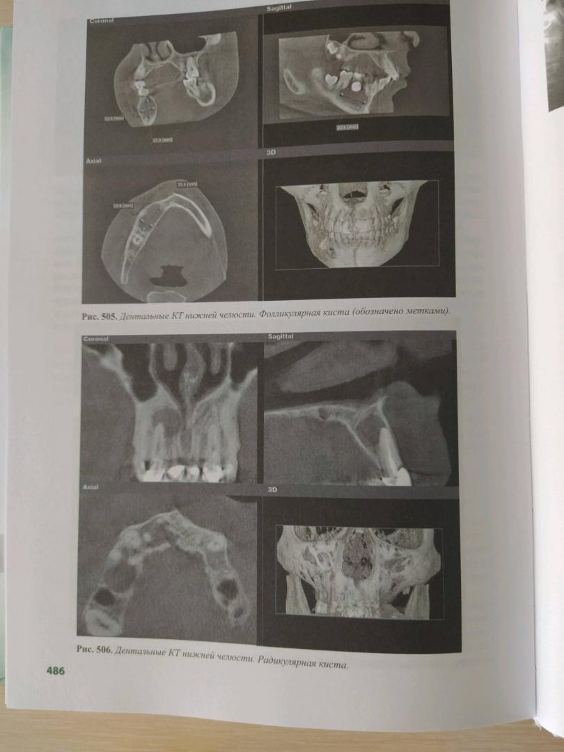 Иллюстрация 52 из 53 для Лучевая диагностика. Учебник - Королюк, Линденбратен | Лабиринт - книги. Источник: Воронцова Анастасия