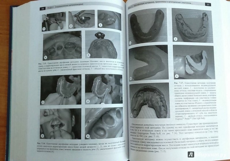 Иллюстрация 10 из 12 для Пропедевтика стоматологических заболеваний. Учебник для студентов вузов - Цепов, Николаев, Аболмасов, Аболмасов | Лабиринт - книги. Источник: Космос