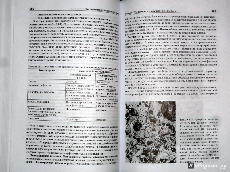 Иллюстрация 12 из 37 для Патологическая анатомия. Учебник - Струков, Серов | Лабиринт - книги. Источник: Лабиринт