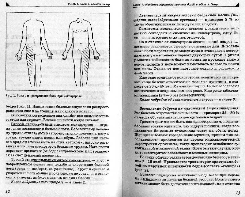 Иллюстрация 4 из 15 для Боль в ногах. Что нужно знать о своем заболевании - Павел Евдокименко | Лабиринт - книги. Источник: Росинка