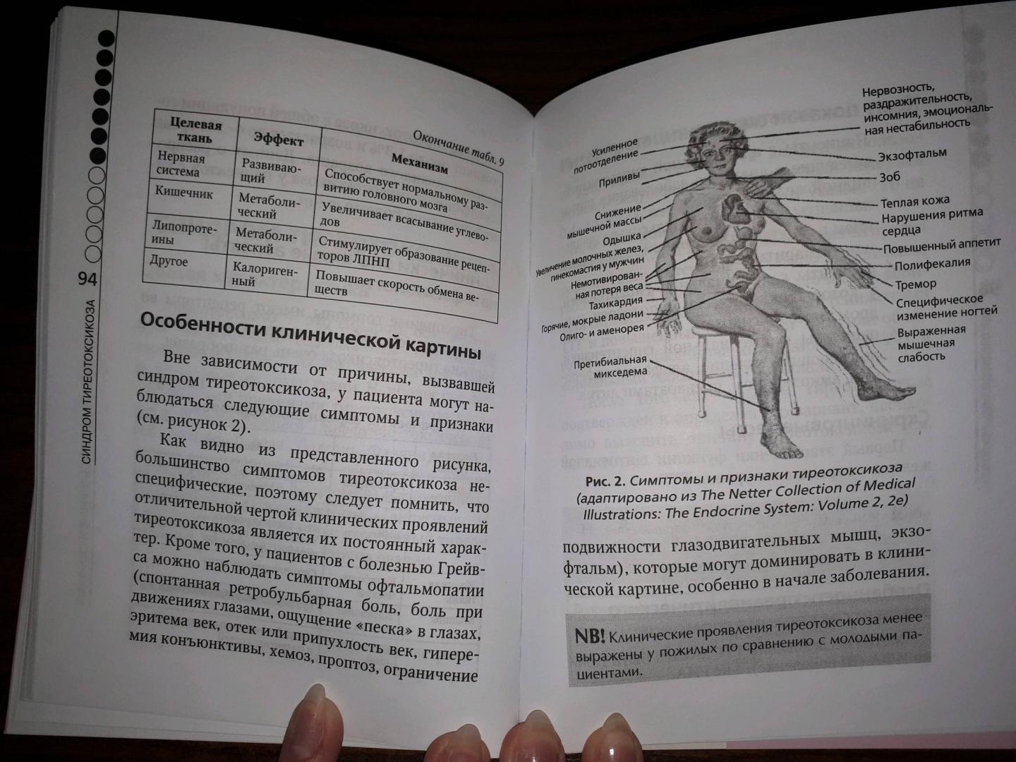 Иллюстрация 20 из 26 для Эндокринные артериальные гипертензии. Руководство для практических врачей - Волкова, Поркшеян | Лабиринт - книги. Источник: Лабиринт