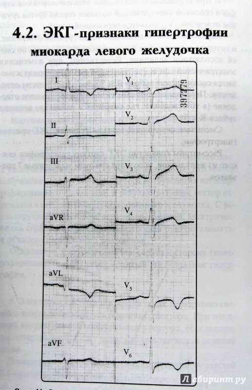 Иллюстрация 19 из 22 для Азбука ЭКГ и Боли в сердце - Юрий Зудбинов | Лабиринт - книги. Источник: Савчук Ирина