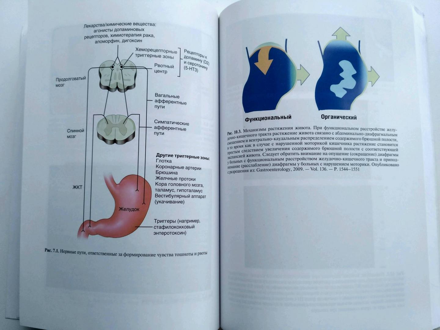Иллюстрация 25 из 31 для Функциональные расстройства желудочно-кишечного тракта. Практический подход на основе клинического - Лэйси, Кроуэлл, ДиБайз | Лабиринт - книги. Источник: Sunnygirl