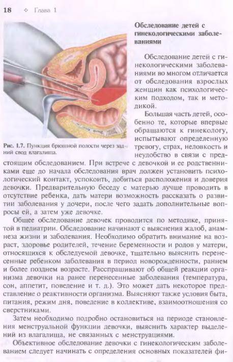 Иллюстрация 13 из 26 для Гинекология | Лабиринт - книги. Источник: Федосов  Прохор Сергеевич