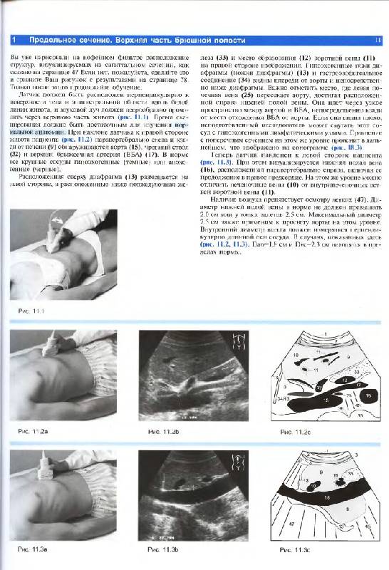 Иллюстрация 9 из 14 для Ультразвуковая диагностика. Базовый курс - Хофер, Райхс | Лабиринт - книги. Источник: Юта